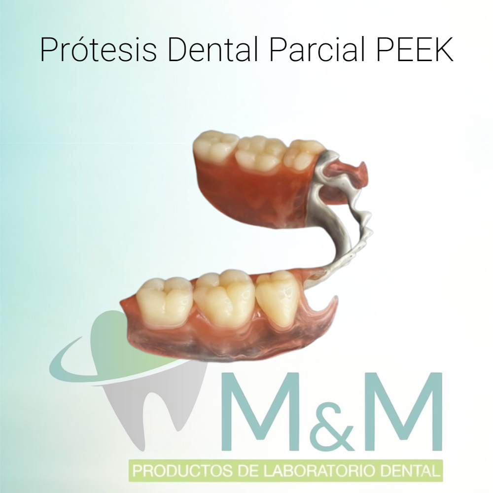 Prótesis Dental Parcial PEEK