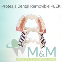Estructura para Prótesis Dental Removible PEEK