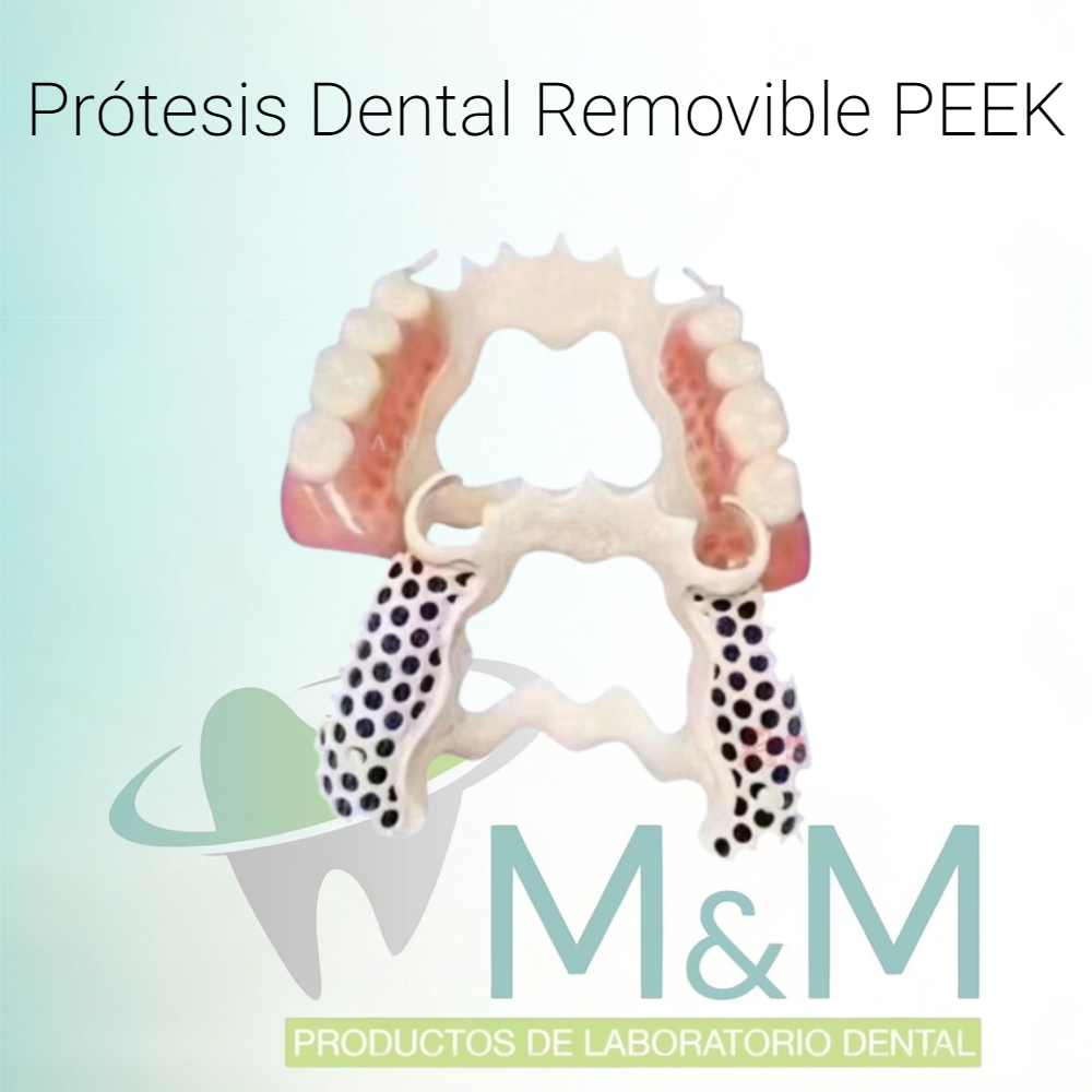 Estructura para Prótesis Dental Removible PEEK